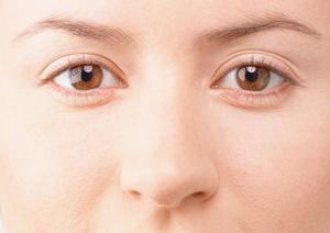 赤あざの悩みを解消！2026年最新レーザー治療の効果と選び方ガイド